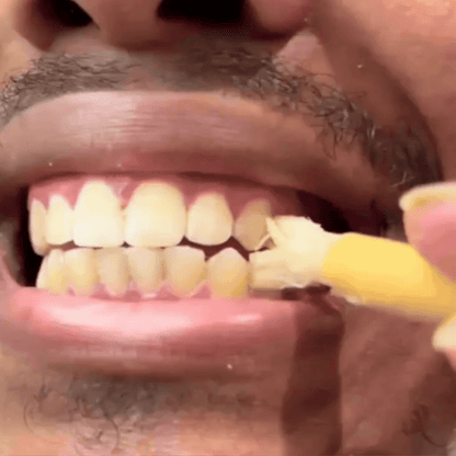 Dentara™